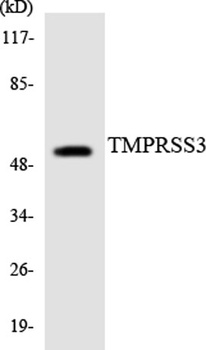 TMPRSS3 antibody