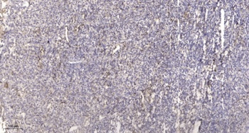 TNF-IP 1 rabbit pAb