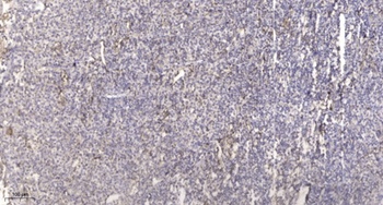 TNF-IP 1 antibody