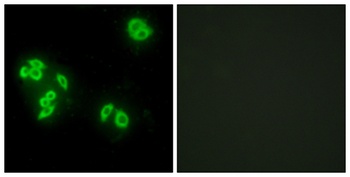 TNF-IP 8 antibody