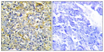 TNF-IP 8 antibody