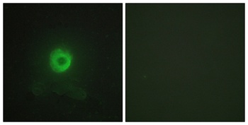 TNF-R2 antibody