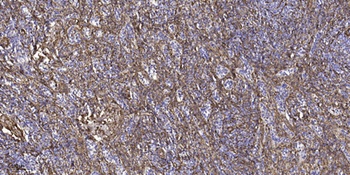 Topo IIIβ-1 rabbit pAb