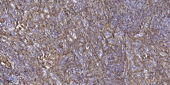 Topo III beta-1 antibody