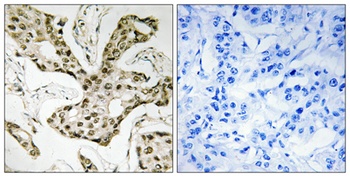 Topo IIα rabbit pAb