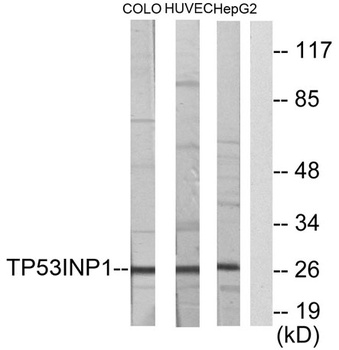 TP53INP1 rabbit pAb
