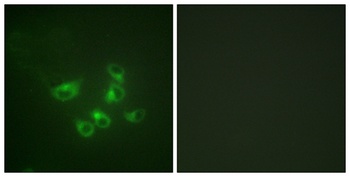 TPH1 antibody