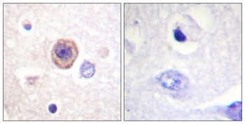 TPH1 rabbit pAb