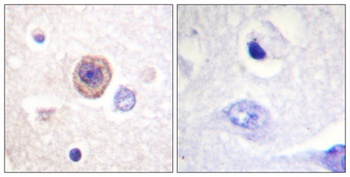 TPH1 antibody