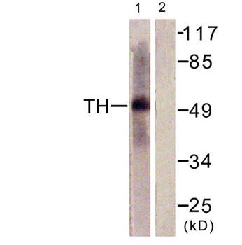 TPH1 rabbit pAb