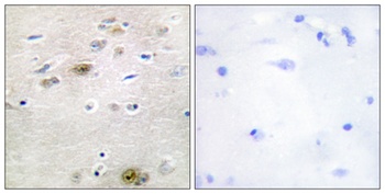 Tra-2α rabbit pAb