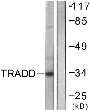 TRADD antibody