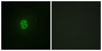 TRAIL antibody