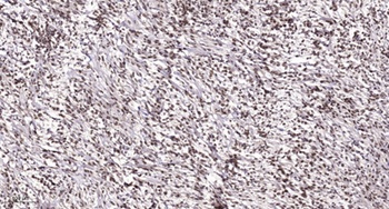 TRAP100 antibody