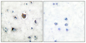 TrkB antibody