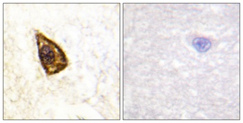 TrkB antibody