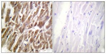 Troponin I-C rabbit pAb