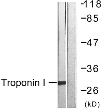 Troponin I-C rabbit pAb