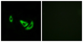 TRP2 antibody