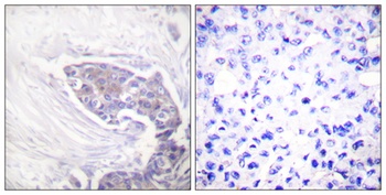 TrxR2 antibody