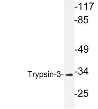 Trypsin-3 antibody
