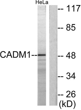 TSLC1 rabbit pAb