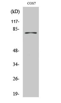 TYR antibody