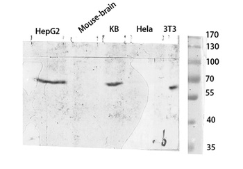 TYR antibody