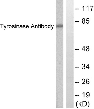 TYR antibody