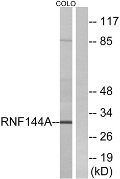 UBCE7IP4 antibody