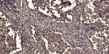 Ubr1 antibody