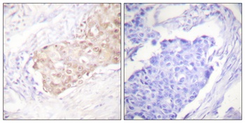 UBR5 antibody