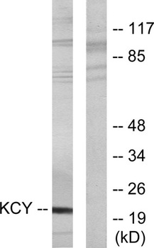 UMP-CMP Kinase rabbit pAb