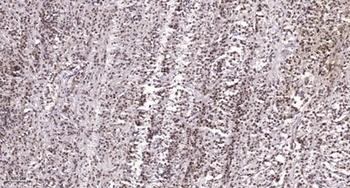 UMP-CMP Kinase antibody
