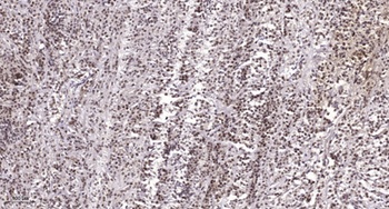 UMP-CMP Kinase rabbit pAb