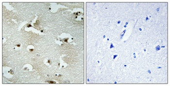 UTP14A rabbit pAb