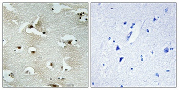 UTP14A antibody