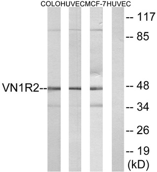 V1RL2 antibody