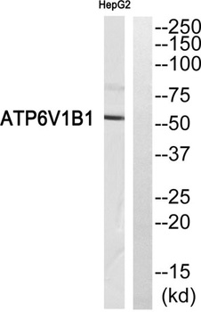 V-ATPase B1 rabbit pAb