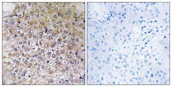 V-ATPase B1 rabbit pAb