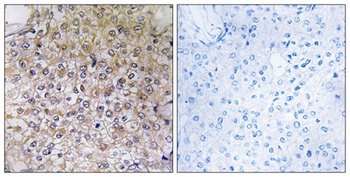 V-ATPase B1 antibody