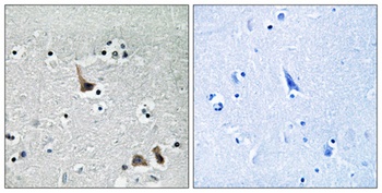 V-ATPase H rabbit pAb