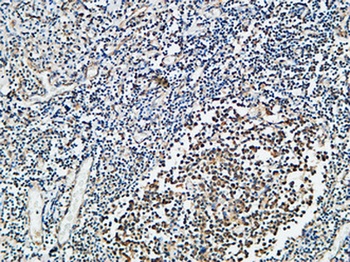 CYP27B1 antibody