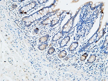 CYP27B1 antibody