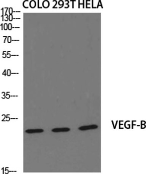 VEGF-B rabbit pAb