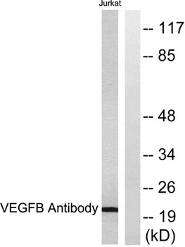 VEGF-B antibody