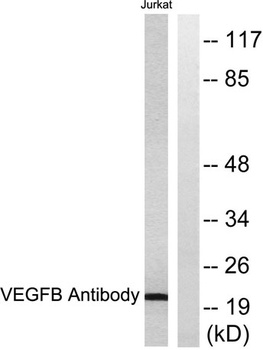 VEGF-B rabbit pAb