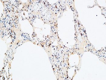 VEGF-D antibody