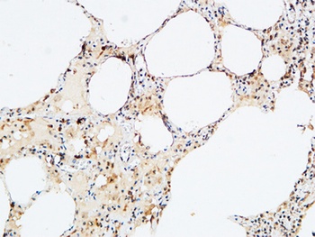 VEGF-D antibody