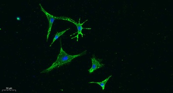 Vinculin rabbit pAb